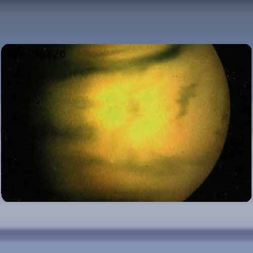 Venus 2/10